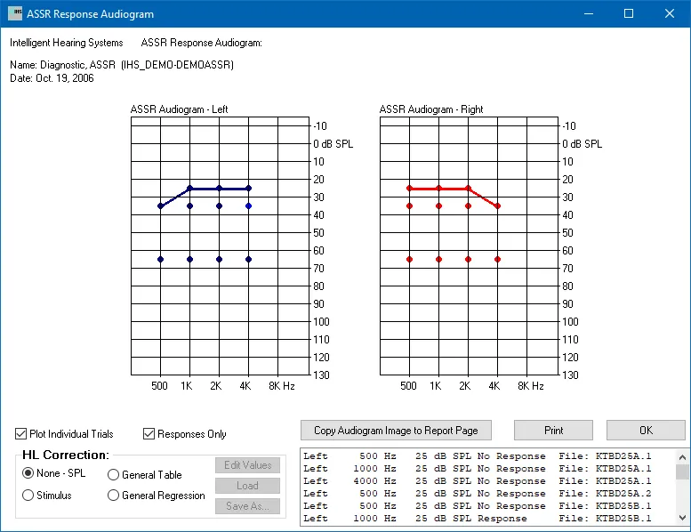 SmartEP ASSR Software Module