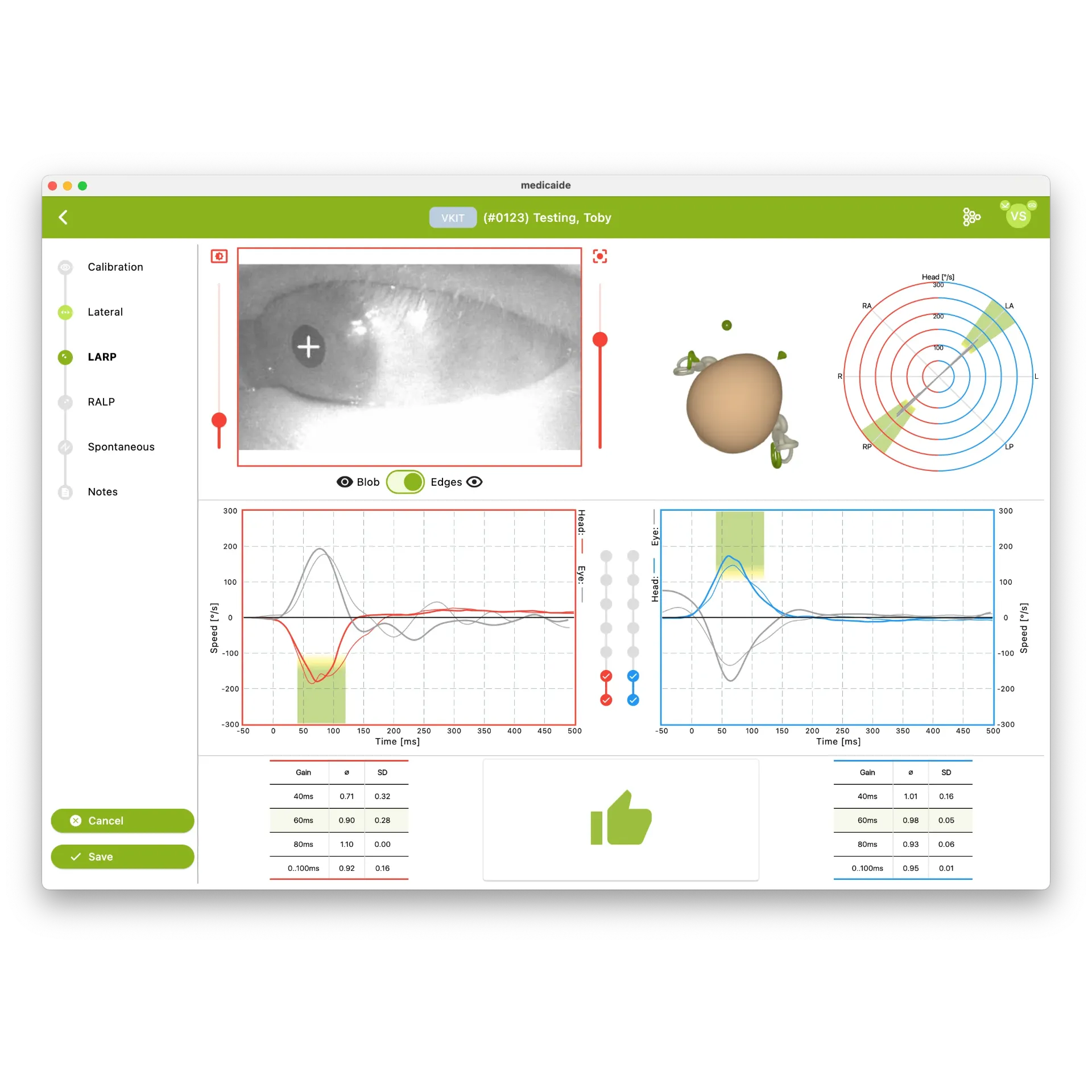 video Head Impulse Test module Merlin