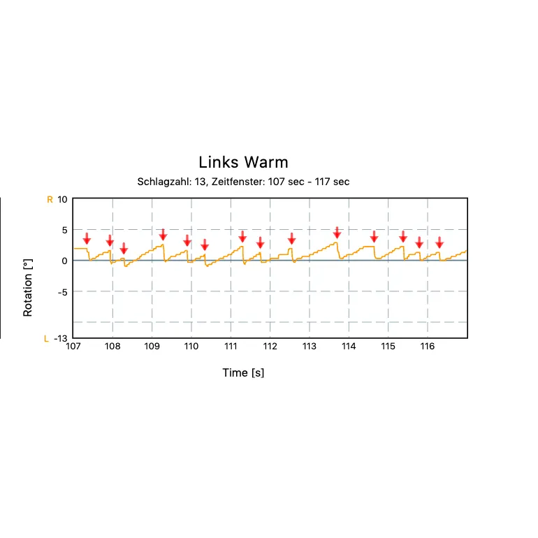 [MER.OP02] Caloric Irrigation Test module Merlin