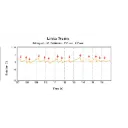 Caloric Irrigation Test module Merlin